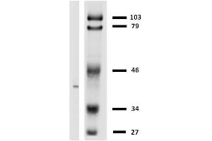 Western blotting analysis of HLA-G in LCL-HLA-G transfectants using anti-HLA-G. (HLAG antibody)