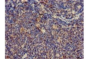 Immunohistochemistry of paraffin-embedded human lymph node tissue using ABIN7171394 at dilution of 1:100 (CD247 antibody  (AA 88-153))