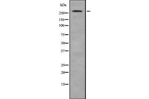 Western blot analysis of ACACB using MCF7 whole  lysates. (Acetyl-CoA Carboxylase beta antibody  (N-Term))