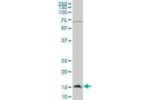 RCP9 polyclonal antibody (A01), Lot # 051018JC01 Western Blot analysis of RCP9 expression in HeLa . (CRCP antibody  (AA 39-148))