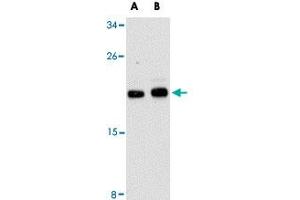Western blot analysis of CLDN1 in HepG2 cell lysate with CLDN1 polyclonal antibody  at (A) 1 and (B) 2 ug/mL . (Claudin 1 antibody  (C-Term))