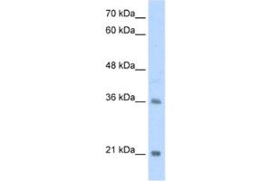 Western Blotting (WB) image for anti-Transcription Factor 15 (Basic Helix-Loop-Helix) (TCF15) antibody (ABIN2461729)