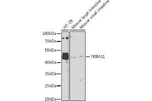 Western blot analysis of extracts of various cell lines, using TRIM31 antibody (ABIN7270987) at 1:1000 dilution. (TRIM31 antibody  (AA 186-425))