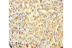 anti-Blepharophimosis, Epicanthus Inversus and Ptosis, Candidate 1 (Non-Protein Coding) (BPESC1) (AA 1-116) antibody