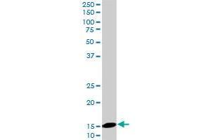 UBE2D2 monoclonal antibody (M02), clone 4A1. (UBE2D2 antibody  (AA 1-94))