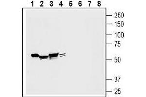 Otopetrin 1 (OTOP1) peptide