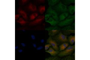ABIN6259968 and ABIN6266497 staining  cells by IF/ICC. (APAF1 antibody  (C-Term))