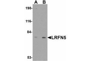Image no. 1 for anti-Leucine Rich Repeat and Fibronectin Type III Domain Containing 5 (LRFN5) (C-Term) antibody (ABIN478054) (LRFN5 antibody  (C-Term))