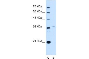 WB Suggested Anti-LHX8 Antibody Titration:  2. (LHX8 antibody  (Middle Region))