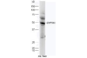Mouse liver lysates probed with Anti-CYP7A1 Polyclonal Antibody, Unconjugated (ABIN739725) at 1:300 in 4˚C. (CYP7A1 antibody  (AA 351-400))