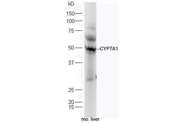 CYP7A1 anticorps  (AA 351-400)