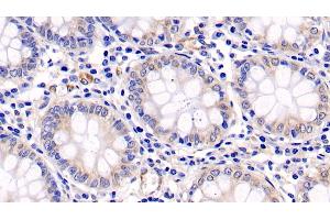 Immunohistochemistry (IHC) image for anti-Mitogen-Activated Protein Kinase 3 (MAPK3) (AA 75-312) antibody (ABIN7426271)