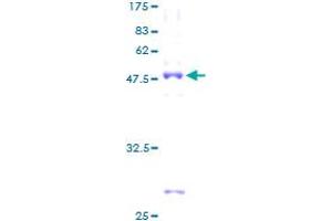 TBPL1 Protein (AA 1-186) (GST tag)