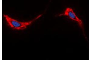 Immunofluorescent analysis of Aquaporin 2 staining in HeLa cells. (AQP2 antibody  (C-Term))
