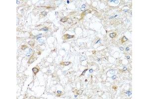 Immunohistochemistry of paraffin-embedded Rat brain using RAC2 Polyclonal Antibody at dilution of 1:100 (40x lens). (RAC2 antibody)