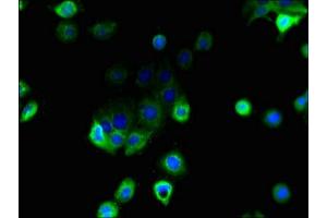 Immunofluorescent analysis of A431 cells using ABIN7158915 at dilution of 1:100 and Alexa Fluor 488-congugated AffiniPure Goat Anti-Rabbit IgG(H+L) (MFSD1 antibody  (AA 1-38))