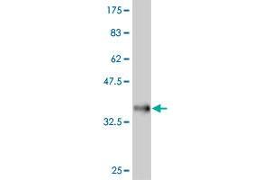 Western Blot detection against Immunogen (35. (FRZB antibody  (AA 102-190))
