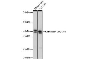 Western blot analysis of extracts of various cell lines, using Cathepsin L/V/K/H Rabbit mAb (ABIN7266150) at 1:1000 dilution. (Cathepsin L antibody)