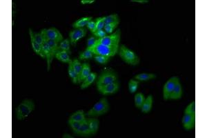 Immunofluorescence staining of HepG2 cells with ABIN7162587 at 1:133, counter-stained with DAPI. (Pannexin 2 antibody  (AA 370-470))