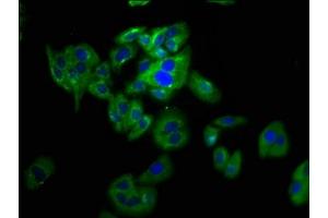 Immunofluorescence staining of HepG2 cells with ABIN7162587 at 1:133, counter-stained with DAPI.