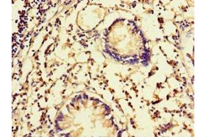 Immunohistochemistry of paraffin-embedded human appendix tissue using ABIN7152505 at dilution of 1:100 (FBXW5 antibody  (AA 265-494))