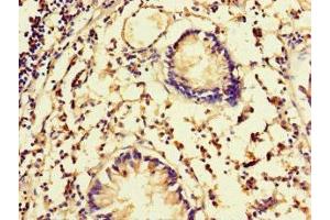 Immunohistochemistry of paraffin-embedded human appendix tissue using ABIN7152505 at dilution of 1:100