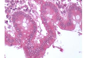 Human Colon: Formalin-Fixed, Paraffin-Embedded (FFPE) (BACE1 antibody  (C-Term))