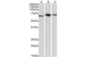 AP32138PU-N PDIA2 antibody staining of Human (A), Mouse (B) and Rat (C) Pancreas lysates (35µg protein in RIPA buffer) at 0.