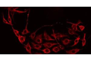 ABIN6277247 staining Hela by IF/ICC. (DKK3 antibody)