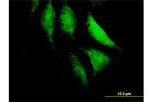 Immunofluorescence of purified MaxPab antibody to HECTD2 on HeLa cell. (HECTD2 antibody  (AA 1-207))