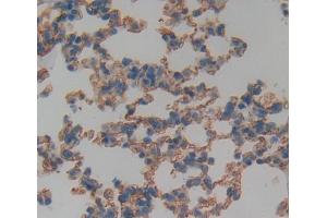 Used in DAB staining on fromalin fixed paraffin- embedded Kidney tissue (TNFRSF19 antibody  (AA 61-163))