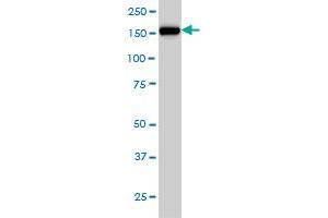 CNAP1 monoclonal antibody (M01), clone 4C12 Western Blot analysis of CNAP1 expression in HeLa . (NCAPD2 antibody  (AA 1240-1339))