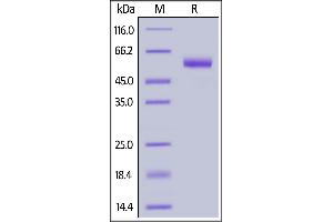 Human CD7, Llama IgG2b Fc Tag, low endotoxin on  under reducing (R) condition. (CD7 Protein (CD7) (AA 26-180) (Fc Tag))