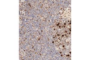 Immunohistochemical analysis of paraffin-embedded Human tonsil tissue using A performed on the Leica® BOND RXm.