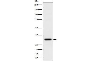 Western blot analysis of BCL2L12 expression in MCF7 cell lysate. (Recombinant BCL2L12 antibody)