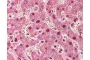 Immunohistochemistry (IHC) image for anti-Protein Phosphatase 1, Regulatory Subunit 13 Like (PPP1R13L) (AA 780-797) antibody (ABIN2470264) (PPP1R13L antibody  (AA 780-797))