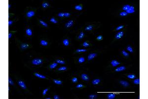 Immunofluorescence of monoclonal antibody to ZNF100 on HeLa cell. (ZNF100 antibody  (AA 99-206))