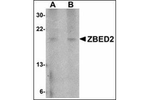 Western blot analysis of ZBED2 in A549 cell lysate with ZBED2 antibody at (A) 1 and (B) 2 µg/ml. (ZBED2 antibody  (N-Term))