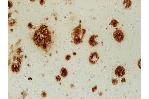 Immunohistochemistry (IHC) image for anti-Abeta 38/40/42 (AA 1-16), (AA 4-8) antibody (ABIN1742439) (Abeta 38/40/42 (AA 1-16), (AA 4-8) antibody)