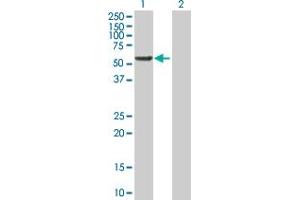 RGS6 antibody  (AA 1-472)