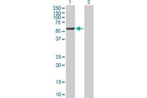 Western Blot analysis of RGS6 expression in transfected 293T cell line by RGS6 MaxPab polyclonal antibody.