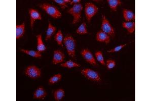 IF analysis of Elovl4 using anti-Elovl4 antibody (ABIN7599257). (ELOVL4 antibody  (AA 1-312))