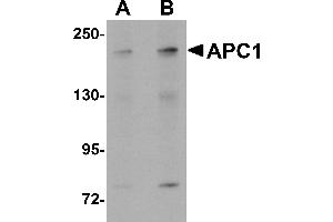 Western Blotting (WB) image for anti-Anaphase Promoting Complex Subunit 1 (ANAPC1) (C-Term) antibody (ABIN1030243) (APC1 antibody  (C-Term))