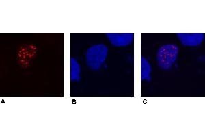 Immunocytochemistry (confocal microscopy) of COS-7 cells transfected with expression constructs encoding fusion nuclear protein with DDDDK epitope.