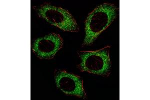 Fluorescent ige of  cell stained with P2K2 Antibody  (ABIN6243254 and ABIN6579024)/SA080220AJ. (MEK2 antibody  (AA 372-400))