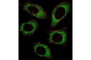 Fluorescent ige of  cell stained with P2K2 Antibody  (ABIN6243254 and ABIN6579024)/SA080220AJ.