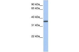 Western Blotting (WB) image for anti-UDP-Galactose-4-Epimerase (GALE) antibody (ABIN2459745) (GALE antibody)