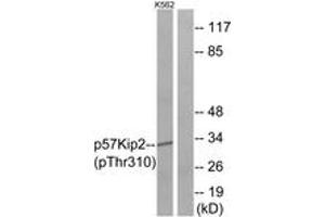 Western blot analysis of extracts from K562 cells treated with insulin 0. (CDKN1C antibody  (pThr310))