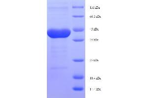 SDS-PAGE (SDS) image for Protease, serine, 1 (Trypsin 1) (PRSS1) (AA 24-246) protein (His-SUMO Tag) (ABIN5710159)
