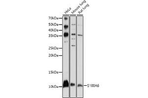 Western blot analysis of extracts of various cell lines, using S100 antibody (ABIN1682611, ABIN3018540, ABIN3018541 and ABIN5664641) at 1:1000 dilution. (S100A6 antibody  (AA 1-90))